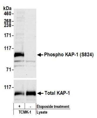 Western Blot: KAP1 [p Ser824] Antibody [NBP2-32073] - Detection of mouse Phospho KAP-1 (S824) by western blot. Samples: Whole cell lysate (50 ug) from TCMK-1 cells treated with etoposide (+) or mock treated (-). Antibody: Affinity purified rabbit anti-Phospho KAP-1 (S824) antibody NBP2-32073 used for WB at 0.1 ug/ml. Detection: Chemiluminescence with an exposure time of 30 seconds. Lower panel: Western blot for total KAP-1 using a different affinity purified rabbit anti-KAP-1 antibody at 0.4 ug/ml with an exposure time of 3 seconds.